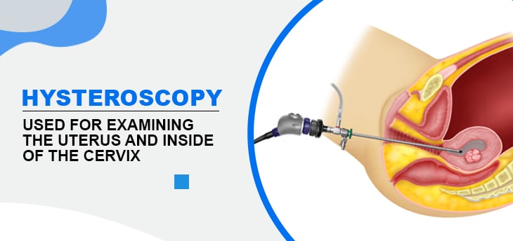 Hysteroscopy with laparoscopy