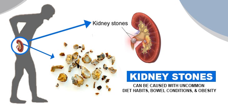 Laparoscopic surgery of kidney stone